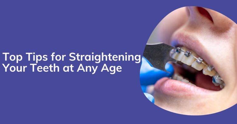 Teeth Straightening Tips You Can Follow at Any Age