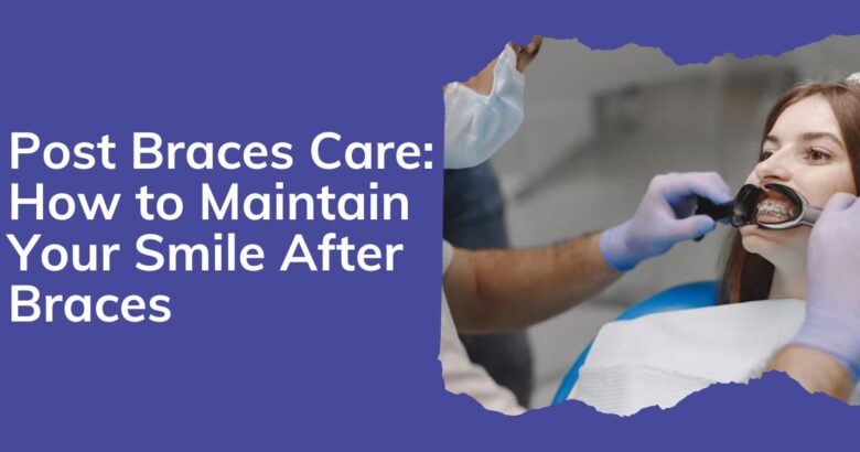 Post Braces Care How to Maintain Your Smile After Braces
