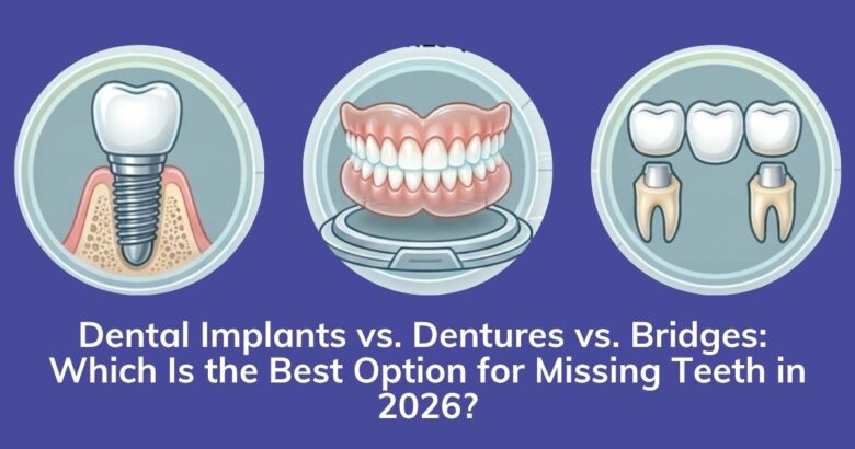 Dental Implants vs. Dentures vs. Bridges: Which Is the Best Option for Missing Teeth in 2026?