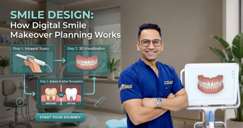 Smile Design: How Digital Smile Makeover Planning Works