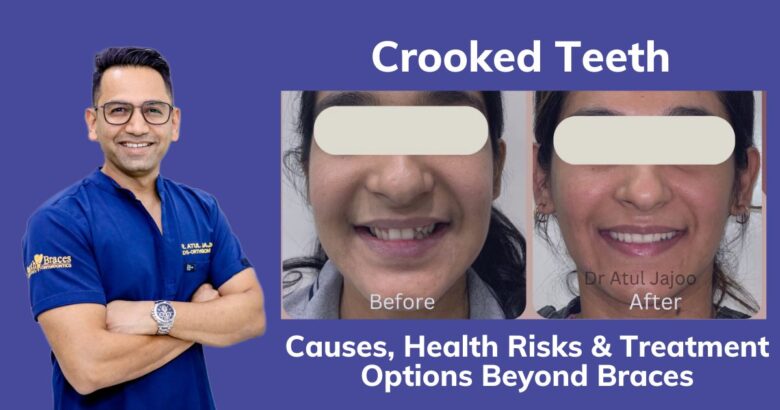 Crooked Teeth Causes, Health Risks & Treatment Options Beyond Braces